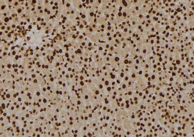 GPR180 Antibody in Immunohistochemistry (Paraffin) (IHC (P))