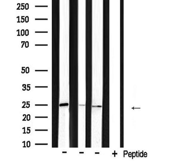 BAK Antibody in Western Blot (WB)