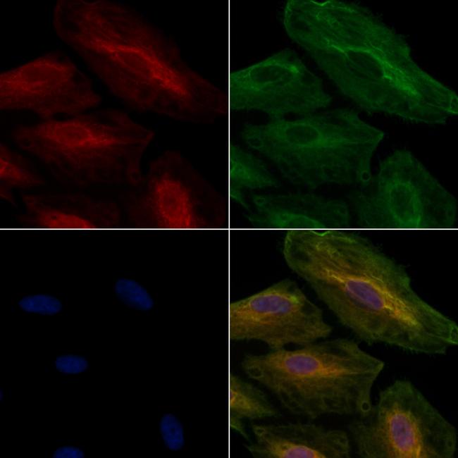 RAP1A Antibody in Immunocytochemistry (ICC/IF)