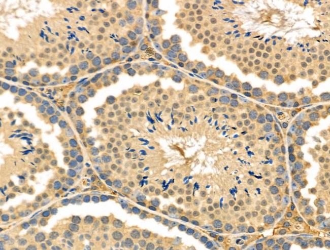 Endothelin 3 Antibody in Immunohistochemistry (Paraffin) (IHC (P))