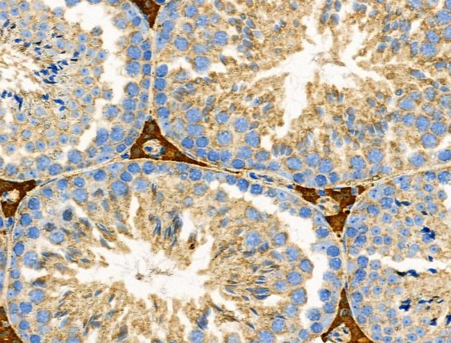 RALBP1 Antibody in Immunohistochemistry (Paraffin) (IHC (P))