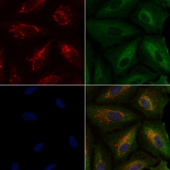 ABO Antibody in Immunocytochemistry (ICC/IF)