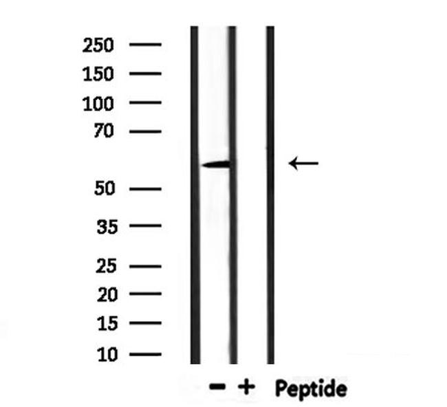 UGT1A9 Antibody in Western Blot (WB)