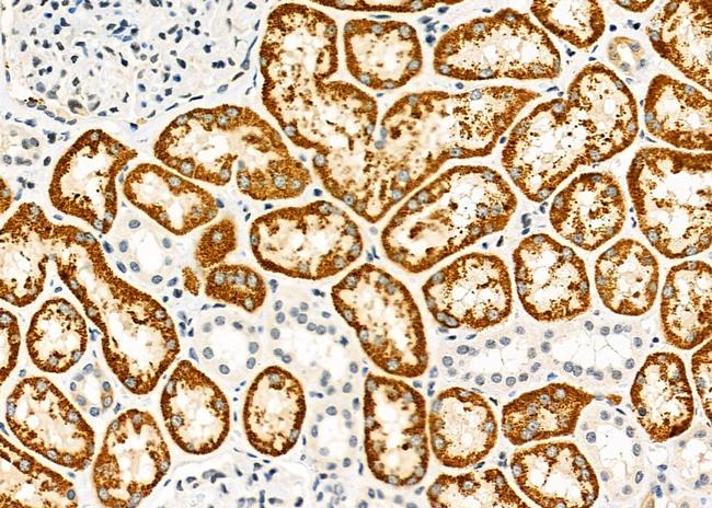 SCNN1B Antibody in Immunohistochemistry (Paraffin) (IHC (P))