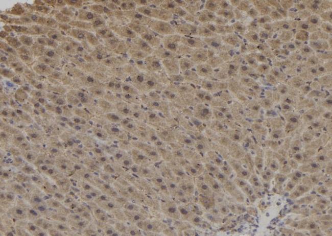 Dynactin 1 Antibody in Immunohistochemistry (Paraffin) (IHC (P))