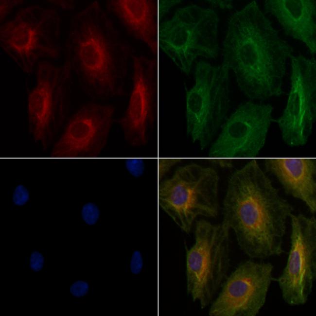 HSD3B2 Antibody in Immunocytochemistry (ICC/IF)