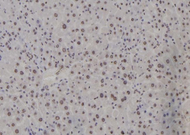 ATF3 Antibody in Immunohistochemistry (Paraffin) (IHC (P))