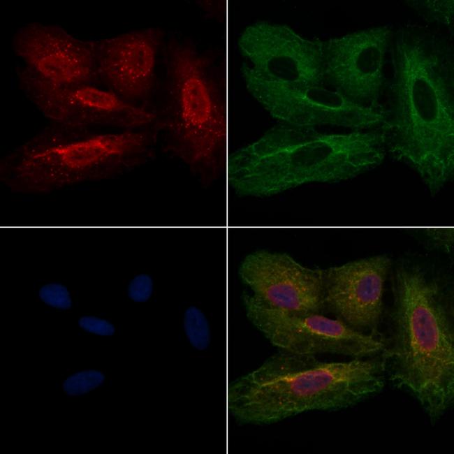 TRIM21 Antibody in Immunocytochemistry (ICC/IF)