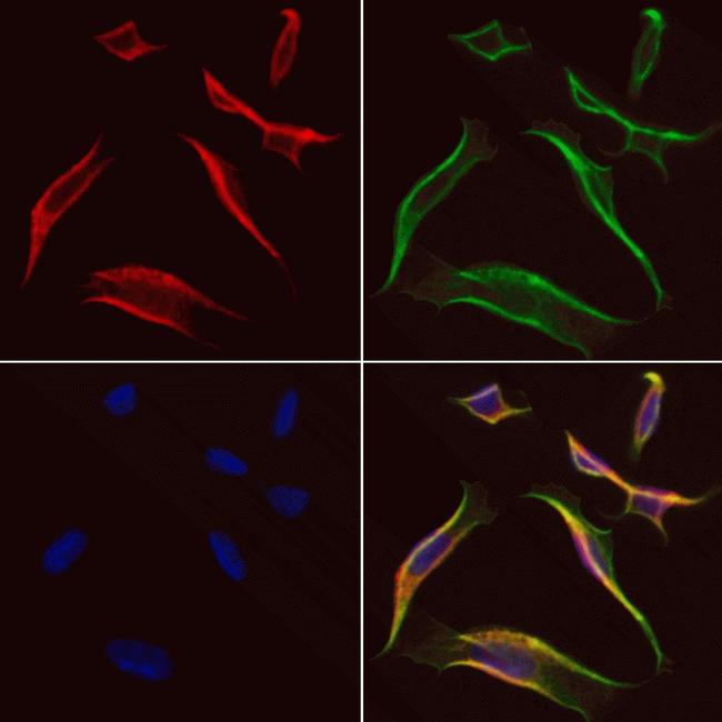 DST Antibody in Immunocytochemistry (ICC/IF)