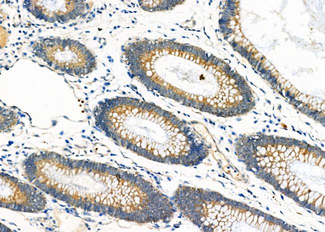 IGF2 Antibody in Immunohistochemistry (Paraffin) (IHC (P))