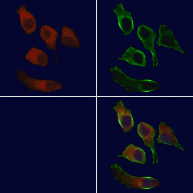 E-selectin Antibody in Immunocytochemistry (ICC/IF)