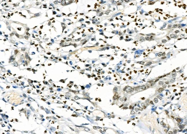 CD16 Antibody in Immunohistochemistry (Paraffin) (IHC (P))