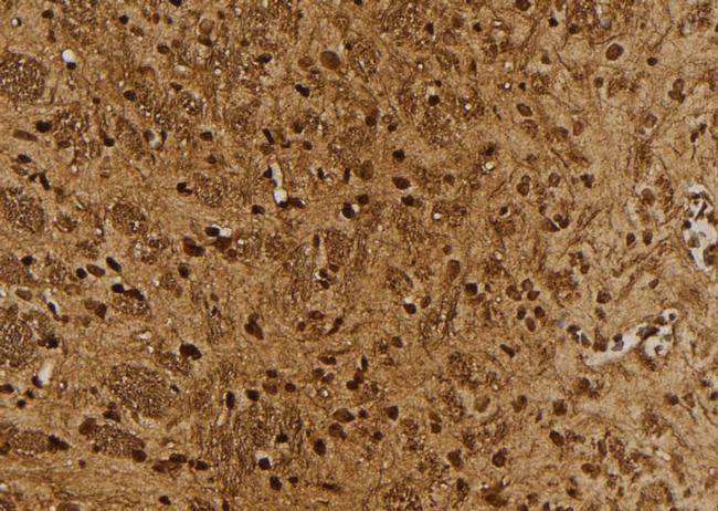 Cullin 4A Antibody in Immunohistochemistry (Paraffin) (IHC (P))