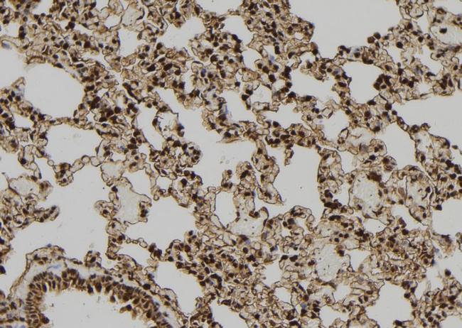 PDX1 Antibody in Immunohistochemistry (Paraffin) (IHC (P))