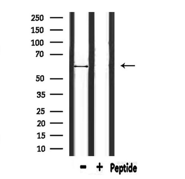 ATL1 Antibody in Western Blot (WB)