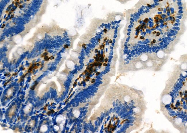 NQO2 Antibody in Immunohistochemistry (Paraffin) (IHC (P))