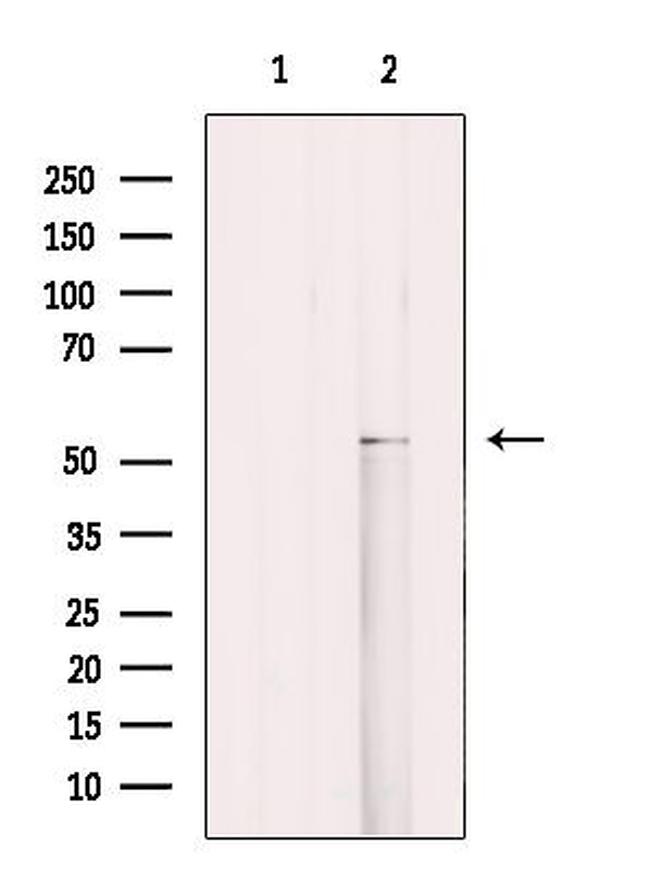 Cytokeratin 12 Antibody in Western Blot (WB)