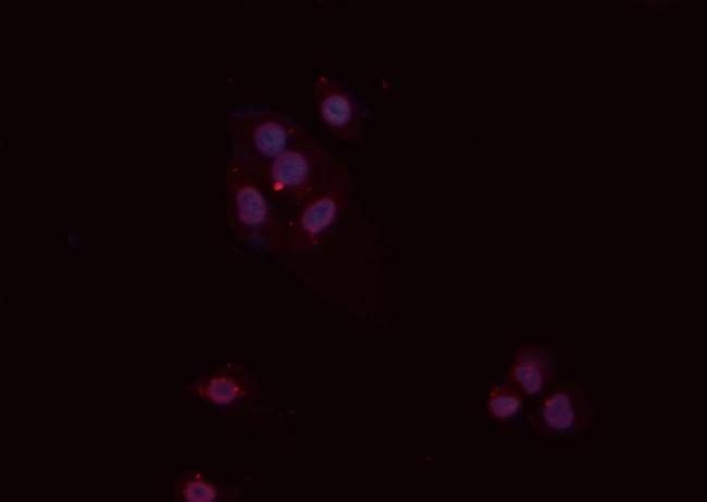 PP2A alpha/beta Antibody in Immunocytochemistry (ICC/IF)