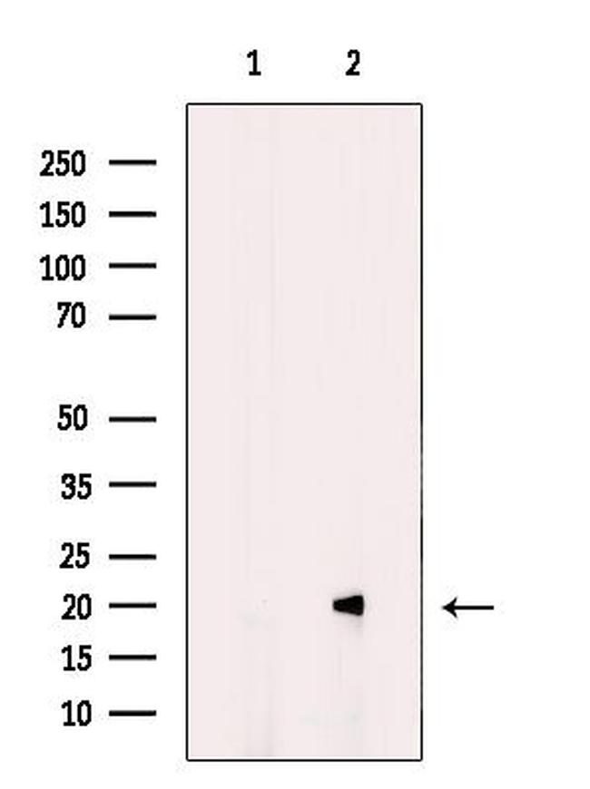 MRAP Antibody in Western Blot (WB)