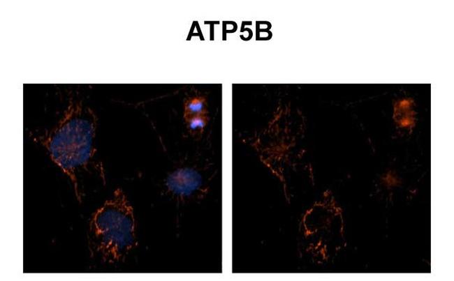 ATP Synthase beta Antibody in Immunohistochemistry (IHC)