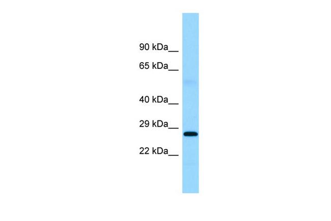 FTMT Antibody in Western Blot (WB)