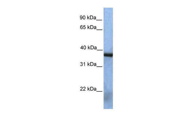 NAA30 Antibody in Western Blot (WB)