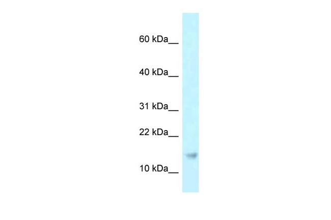 RPP21 Antibody in Western Blot (WB)