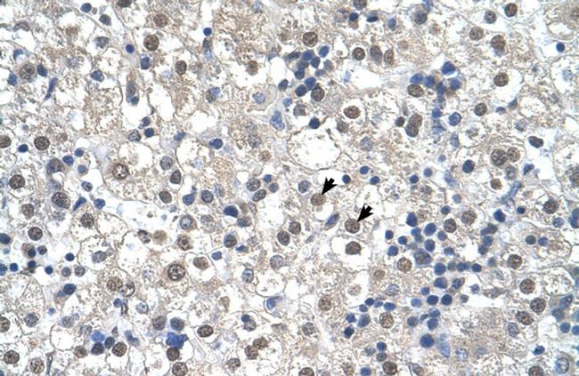 RTN2 Antibody in Immunohistochemistry (IHC)