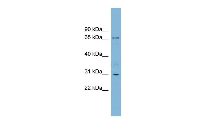 TBCCD1 Antibody in Western Blot (WB)