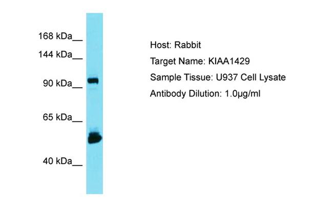 KIAA1429 Antibody in Western Blot (WB)