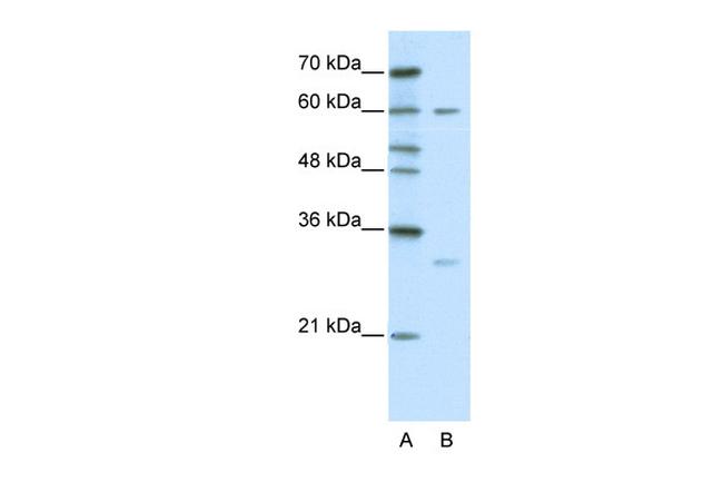 HDBP2 Antibody in Western Blot (WB)