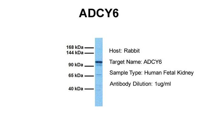 Adenylate Cyclase 6 Antibody in Western Blot (WB)