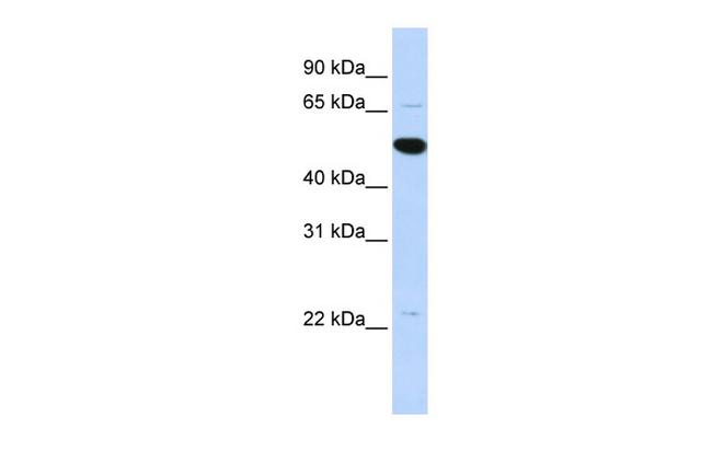 ARHGAP36 Antibody in Western Blot (WB)