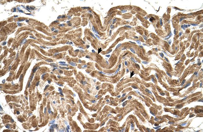 ATP Synthase beta Antibody in Immunohistochemistry (IHC)