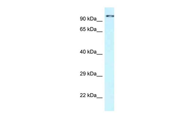 CDK11A Antibody in Western Blot (WB)