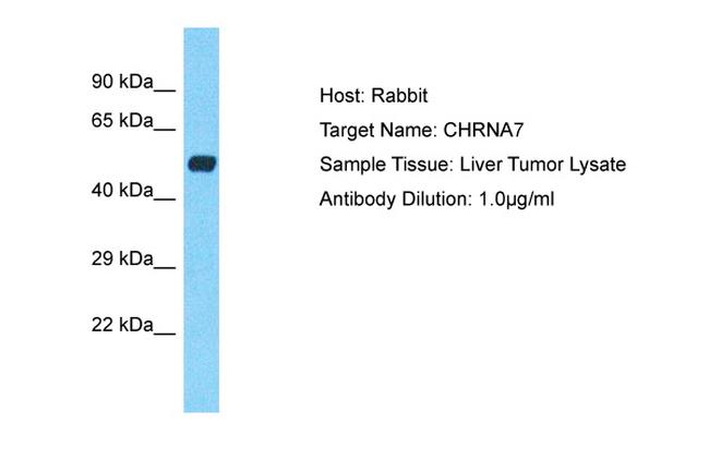 CHRNA7 Antibody in Western Blot (WB)