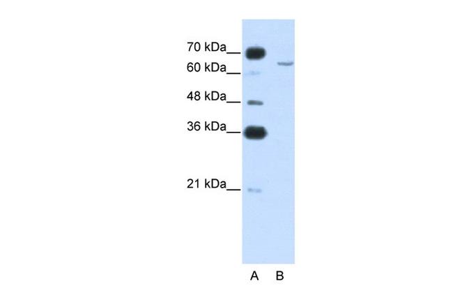 CPEB2 Antibody in Western Blot (WB)