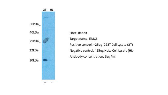 EMC6 Antibody in Western Blot (WB)