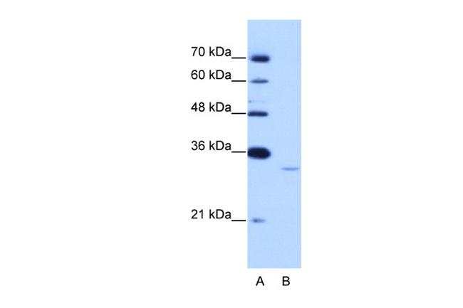 EXOSC6 Antibody in Western Blot (WB)