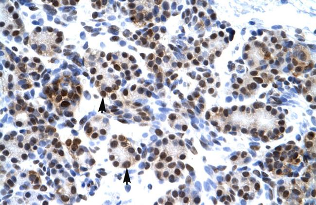 HES7 Antibody in Immunohistochemistry (Paraffin) (IHC (P))