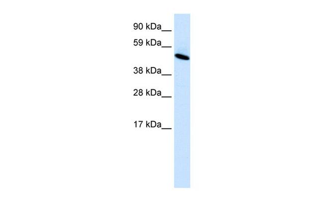 IA-1 Antibody in Western Blot (WB)