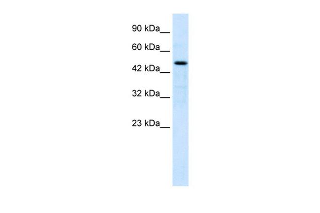 LHX9 Antibody in Western Blot (WB)