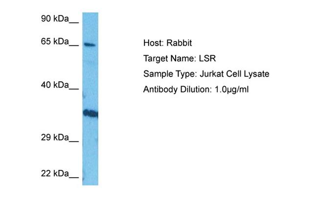 LSR Antibody in Western Blot (WB)