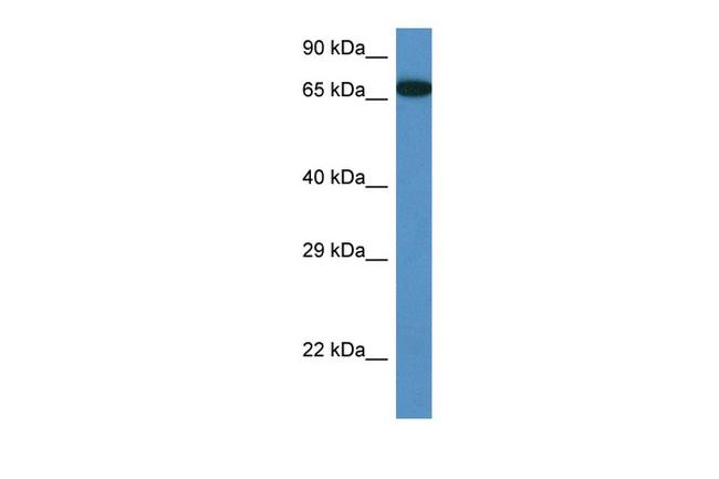 MBTD1 Antibody in Western Blot (WB)