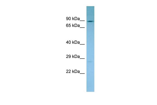 NADSYN1 Antibody in Western Blot (WB)