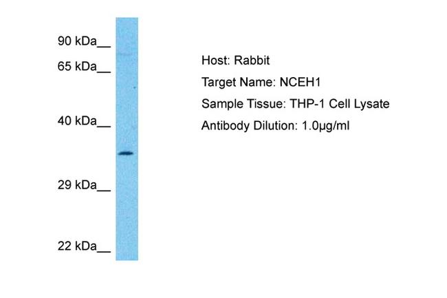 NCEH1 Antibody in Western Blot (WB)