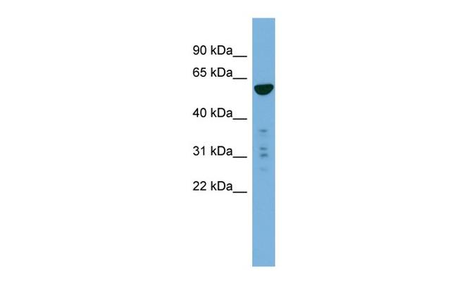 PTDSS2 Antibody in Western Blot (WB)