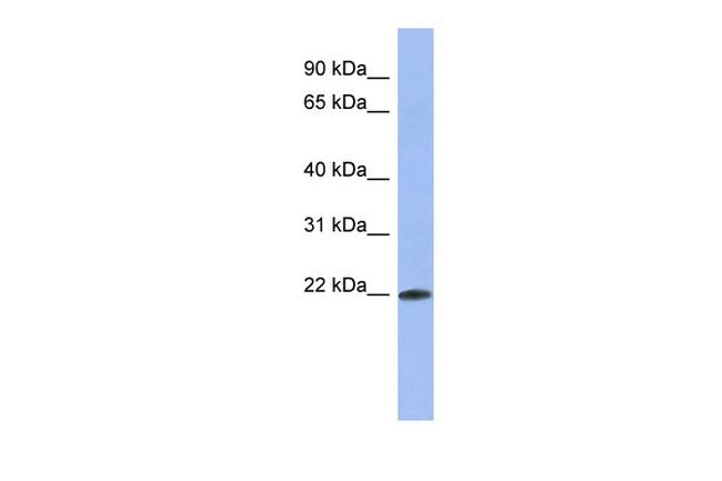 RBM38 Antibody in Western Blot (WB)