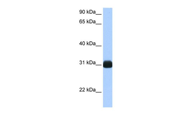 RBPMS Antibody in Western Blot (WB)