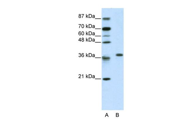 RPL6 Antibody in Western Blot (WB)